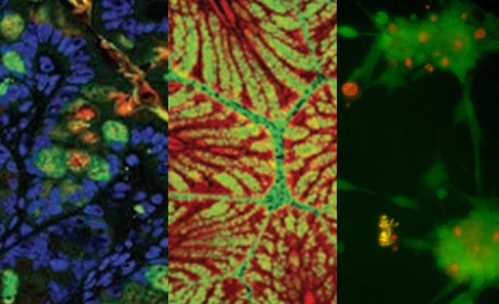 Single-cell approaches and omics - STIRE